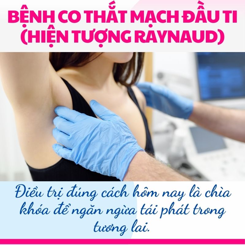 điều trị bệnh con thắt đầu ti khi cho con bú